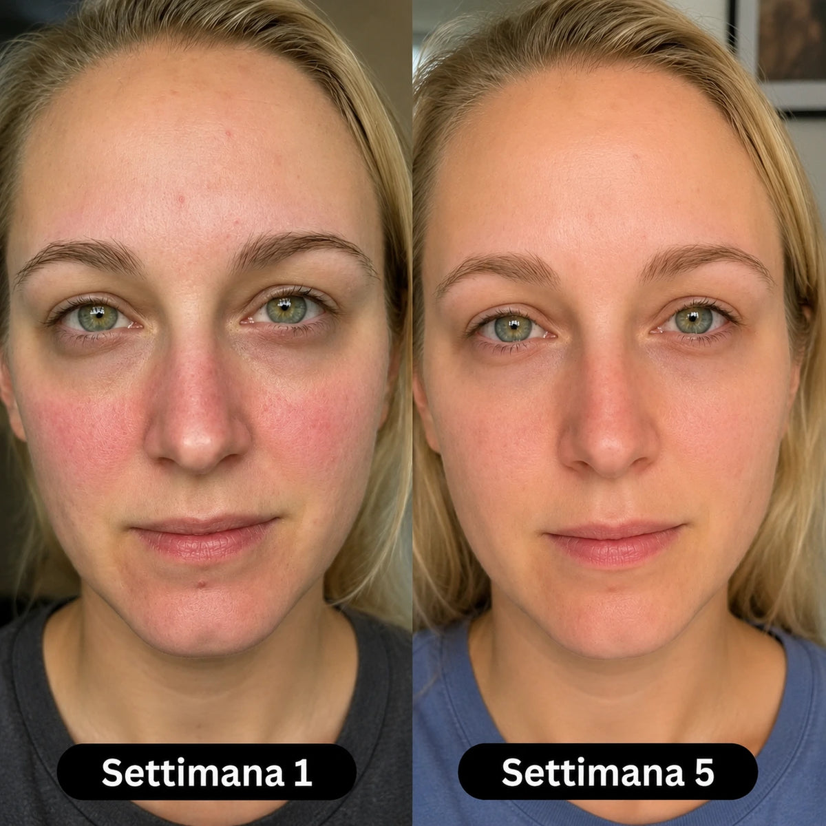 Siero al collagene coreano per pelli mature