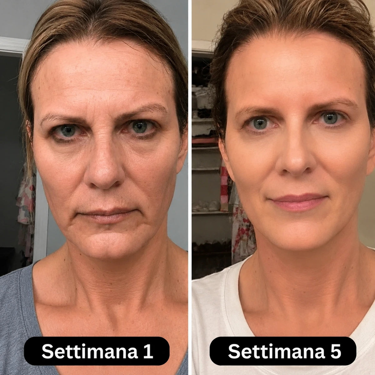 Siero al collagene coreano per pelli mature