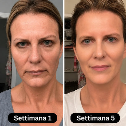 Siero al collagene coreano per pelli mature