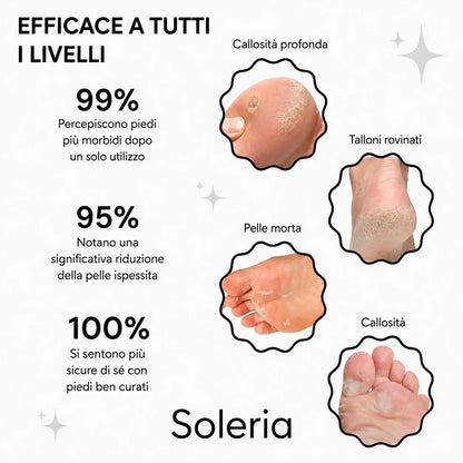 Soleria Glow™ – Kit per la bellezza dei piedi