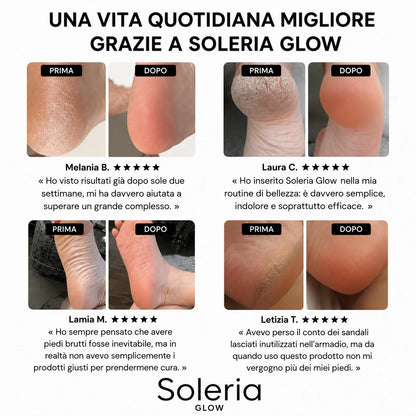 Soleria Glow™ – Kit per la bellezza dei piedi